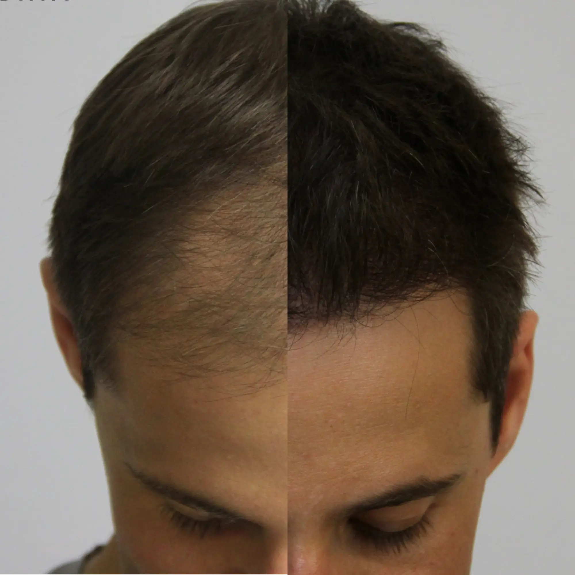 before/after